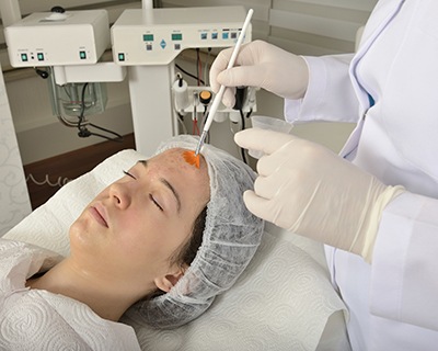 Chemical Skin Peels