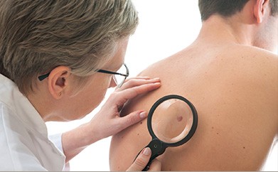Skin Cancer Checks